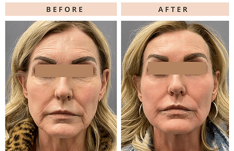 1761949058_145fc3_0374c9c27fe340cc9d7b6fb342191505_mv2 1761949058 145fc3 0374c9c27fe340cc9d7b6fb342191505 mv2 1