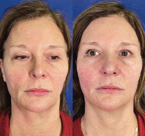 1761949265_145fc3_fbdf2243f9e74119827fc16b06450bbc_mv2 1761949265 145fc3 fbdf2243f9e74119827fc16b06450bbc mv2 1