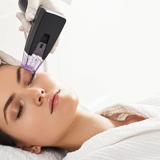 1761949335_morpheus8-behandlung-dermanence-zuerich-01_edited 1761949335 morpheus8 behandlung dermanence zuerich 01 edited 1