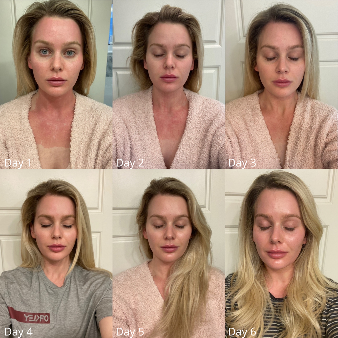 Before and After Image: CoolPeel - front